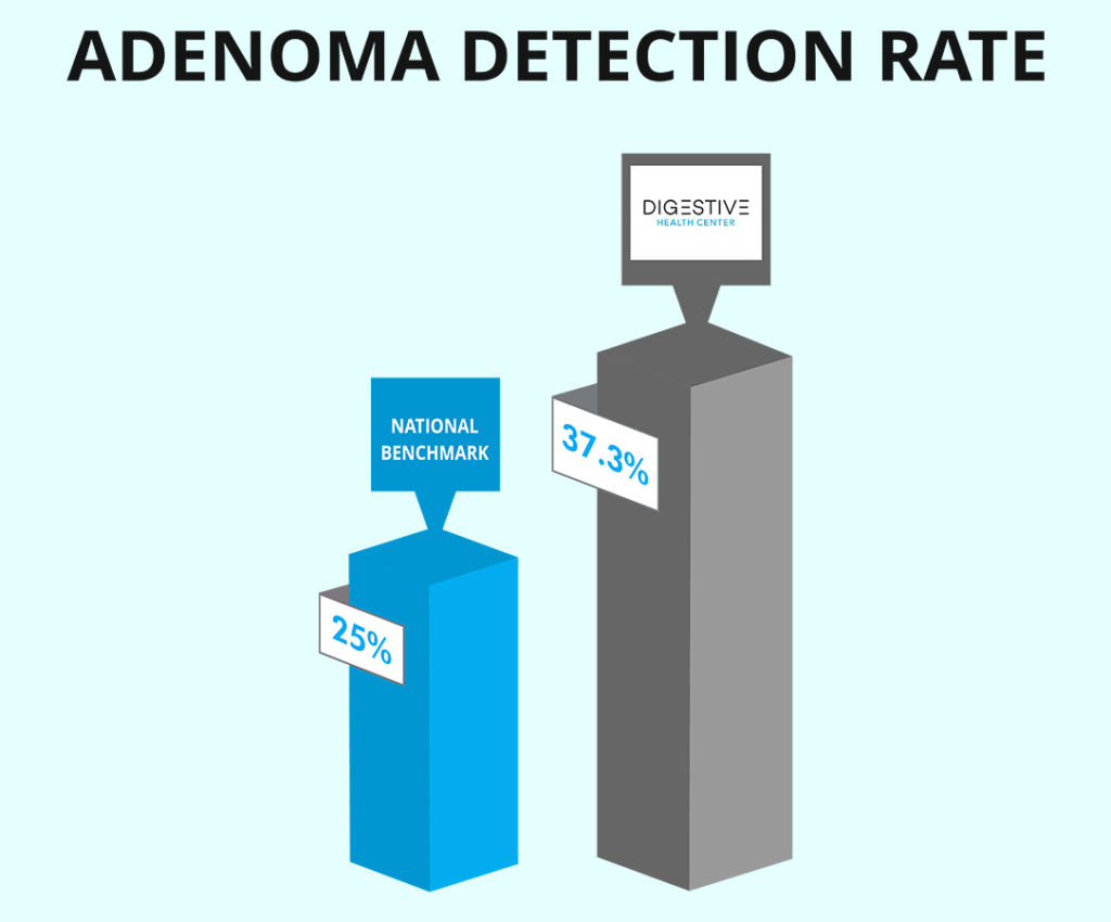 Infographic - Adenoma Detection Rate